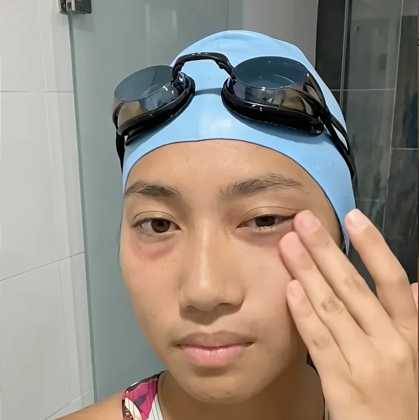 Swimmer pointing to red eye marks after training — a relatable problem for regular swimmers