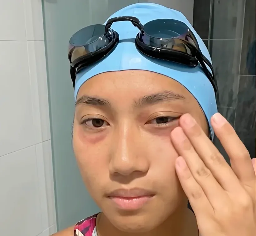 Swimmer with red goggle marks around eyes after training — the skin around your eyes gets bruised